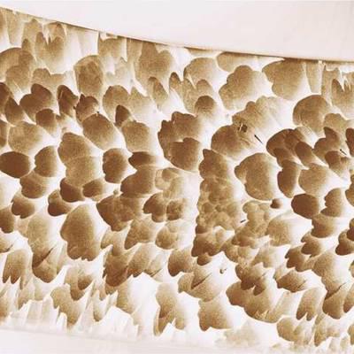 Osteoporose: Innovative Verfahren in der Knochendichtemessung