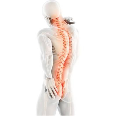 Rückenschmerzen: Volkskrankheit Nr. 1