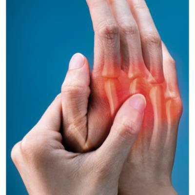 Rheuma II: Neue Behandlungsansätze bei rheumatoider Arthritis