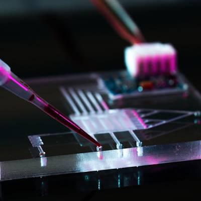 Lab-on-a-Chip: Kleines Labor, große Wirkung