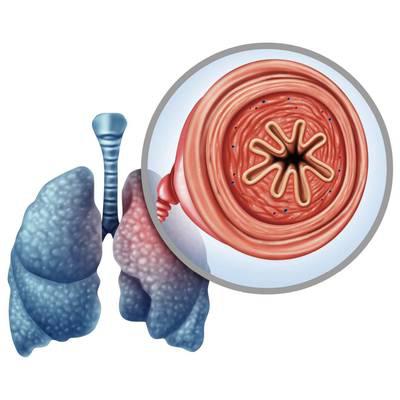 COPD: Schweregrad neu klassifiziert