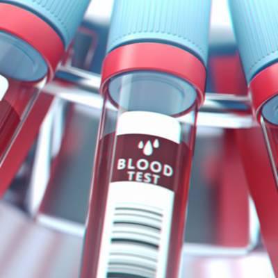 Neue Bluttests bei Brustkrebs, Alzheimer und Aspergillen